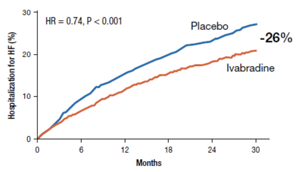 Nghiên cứu SHIfT, ivabradine làm giảm tỷ lệ nhập viện do suy tim nặng lên