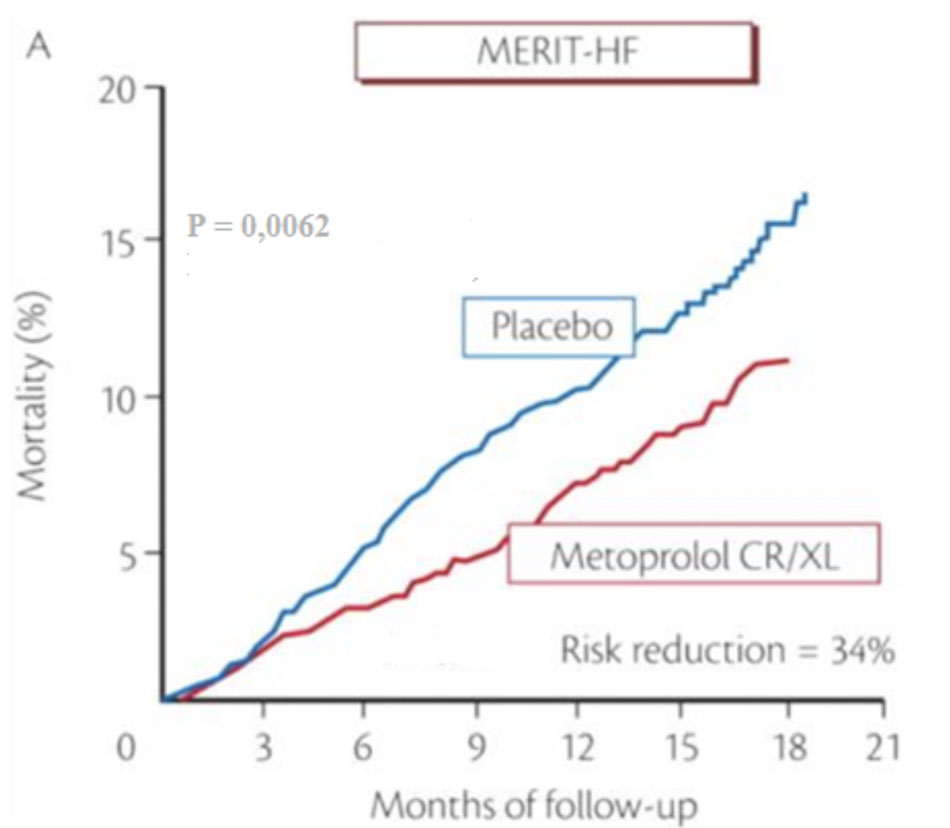 Nghiên cứu MERIT – HF, metoprolol làm giảm tỷ lệ tử vong trong suy tim