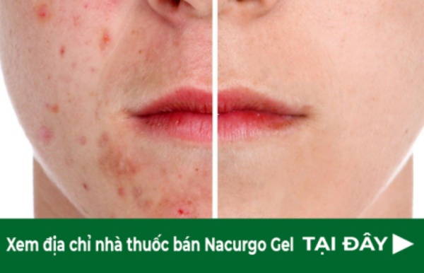 Địa chỉ nhà thuốc bán Nacurgo Gel