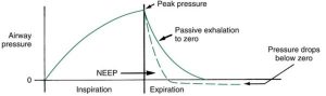 Hình 3.13 Áp lực âm cuối thì thở ra (NEEP). Thở ra xảy ra nhanh hơn, và áp lực giảm xuống dưới đường cơ bản (áp lực âm) so với thở ra thụ động bình thường đến áp lực cuối thì thở ra bằng zero.