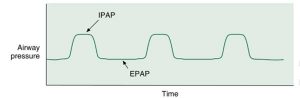 Hình 3.18 Áp lực đường thở dương thì hít vào (IPAP) cộng với áp lực đường thở dương thì thở ra (EPAP). IPAP cao hơn EPAP khi áp dụng cho bệnh nhân. Kỹ thuật này, còn được gọi là áp lực đường thở dương hai mức, hoặc BiPAP, được sử dụng để thông khí không xâm lấn trong thở máy tại nhà.