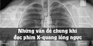 Những vấn đề chung khi đọc phim X-quang lồng ngực