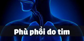 Phù phổi do tim