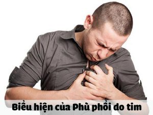 Biểu hiện của Phù phổi do tim