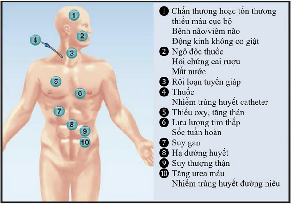 HÌNH 40.1 Các nguyên nhân thường gặp của thay đổi ý thức.