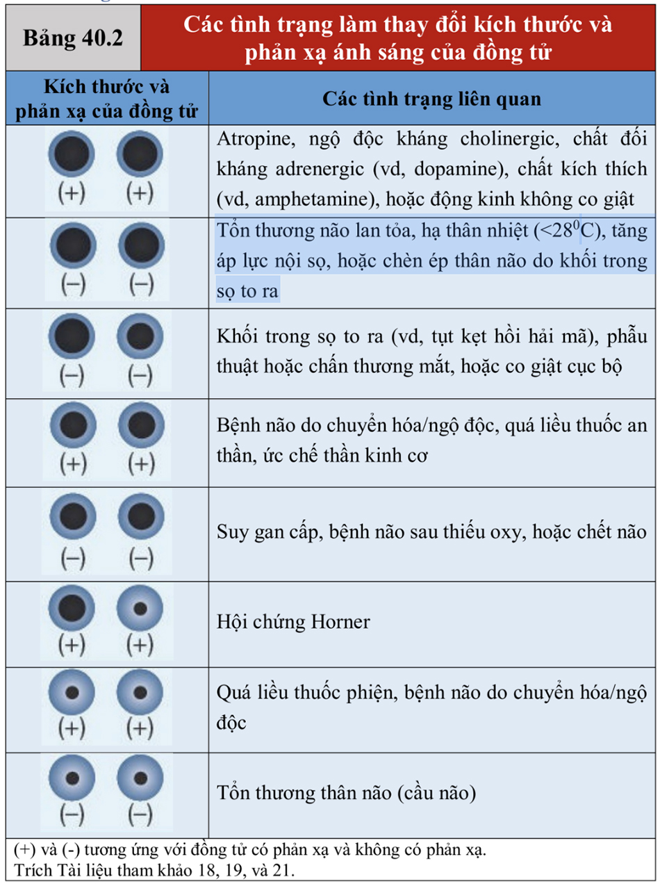 Các tình trạng làm thay đổi kích thước và phản xạ ánh sáng của đồng tử