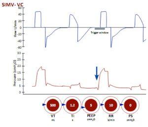 Hình 19 Thông khí bắt buộc ngắt quãng đồng bộ theo kiểm soát thể tích (SIMV-VC) không kèm PS