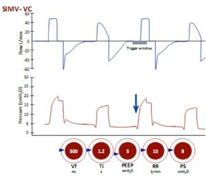 Hình 20 Thông khí bắt buộc ngắt quãng đồng bộ theo kiểm soát thể tích (SIMV-VC) có kèm PS