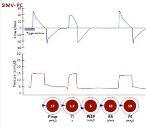 Hình 21 Thông khí bắt buộc ngắt quãng đồng bộ theo kiểm soát áp lực (SIMV-PC) có kèm PS