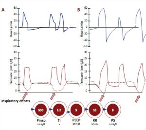 Hình 25 Chu kỳ kép và tự động kích hoạt (Double cycle and autotriggering)