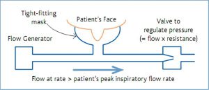 Diagram of CPAP circuit