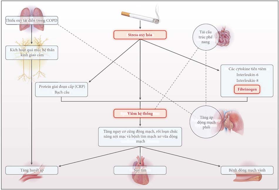 Các cơ chế tiềm năng về mối liên quan của bệnh phổi tắc nghẽn mạn tính (COPD) với tăng huyết áp và các bệnh tim mạch khác.