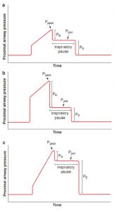 Hình 4.3 Dạng sóng áp lực với thủ thuật tạm dừng hít vào. (a) Áp lực đỉnh và bình nguyên bình thường. (b) Áp lực đỉnh tăng nhưng áp lực bình nguyên bình thường. Áp lực đỉnh tăng là do tăng trong thành phần sức cản của áp lực đường thở gần (PR). (c) Áp lực đỉnh tăng và áp lực bình nguyên tăng. Áp lực đỉnh tăng là do tăng trong thành phần đàn hồi của áp lực đường thở gần (PE).