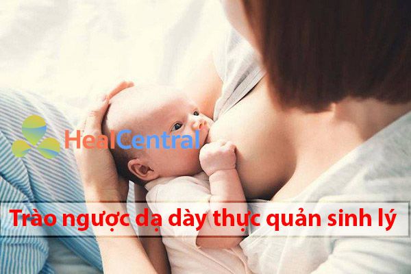 Trào ngược dạ dày thực quản sinh lý ở trẻ bú mẹ