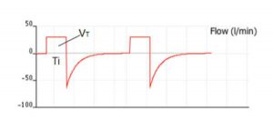 Hình 1. Kiểu lưu lượng hằng định (vuông) trong VCV