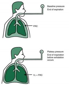 Hình 1.11 Ở áp lực nền (kết thúc thở ra), thể tích không khí còn lại trong phổi là dung tích cặn chức năng (FRC). Khi hết hít vào, trước khi bắt đầu thở ra, thể tích không khí trong phổi là thể tích khí lưu thông (VT) cộng với FRC. Áp lực đo tại thời điểm lưu lượng bằng zero, là áp lực cao nguyên.