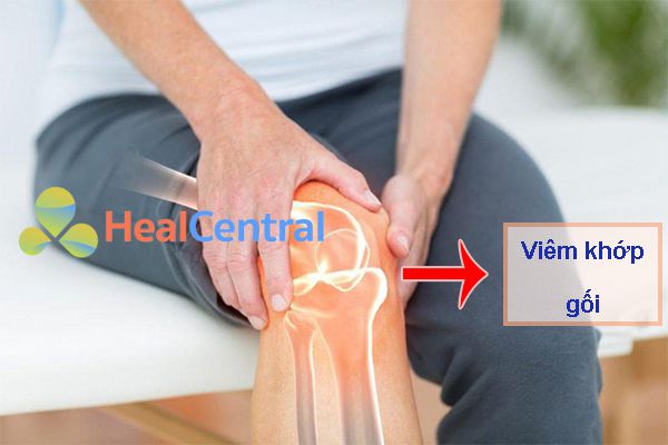 Viêm khớp gối: dấu hiệu nhận biết, triệu chứng & các phương pháp điều trị
