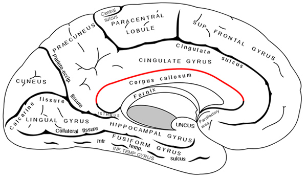 Ảnh. Thể chai nếu nhìn bên (Phần màu đỏ: Corpus callosum).