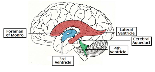 Ảnh. Hệ thống não thất với 4 não thất và các đường ống thông với nhau.