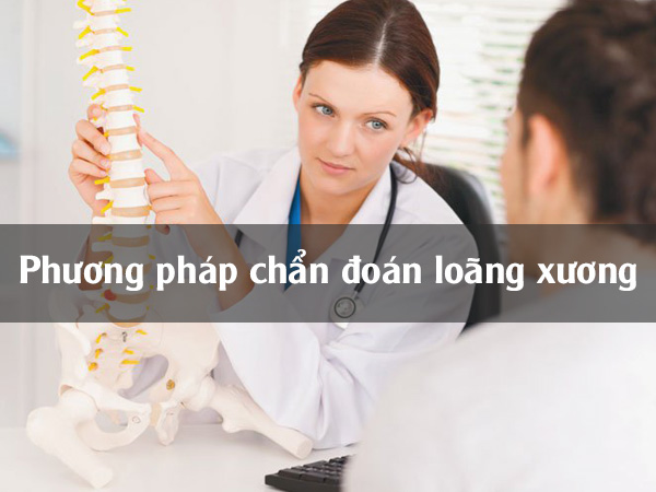 Chẩn đoán loãng xương