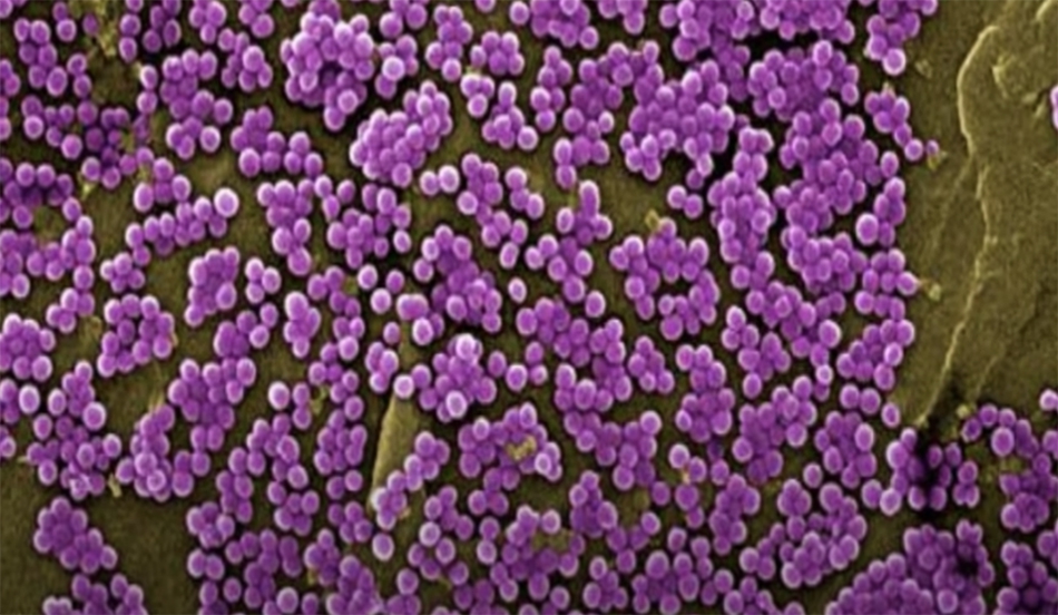  Staphylococcus aureus