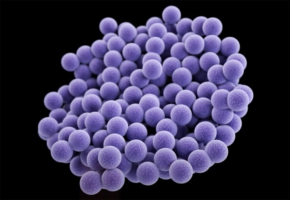 Staphylococcus aureus