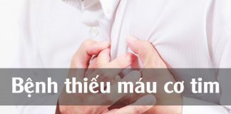 Bệnh thiếu máu cơ tim