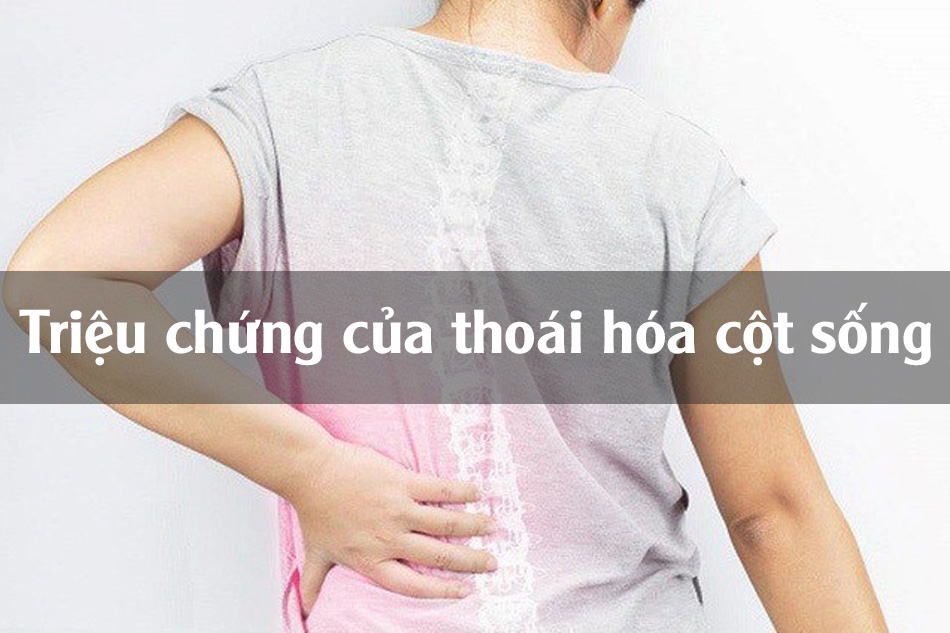 Triệu chứng của thoái hóa cột sống