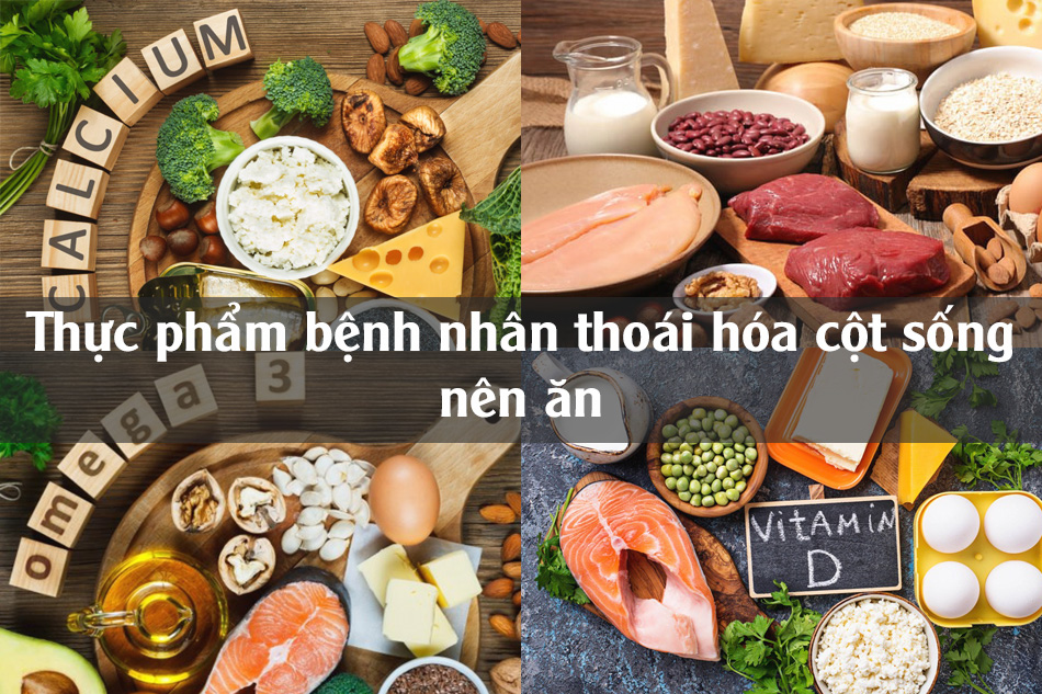 Thực phẩm bệnh nhân thoái hóa cột sống nên ăn