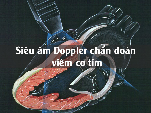 Siêu âm Doppler chẩn đoán viêm cơ tim