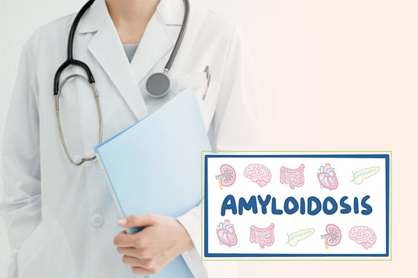 Bệnh Amyloidosis là bệnh gì? Triệu chứng, chẩn đoán & điều trị