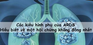 Các kiểu hình phụ của ARDS: Hiểu biết về một hội chứng không đồng nhất