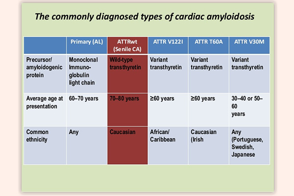 Các loại Amyloidosis thường gặp