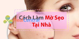 Cách làm mờ sẹo tại nhà hiệu quả và nhanh chóng