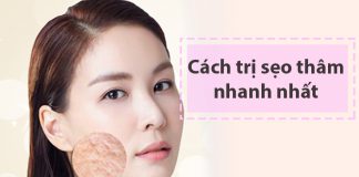 Cách trị sẹo thâm nhanh nhất