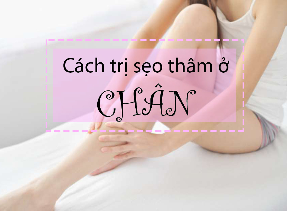 Các cách trị sẹo thâm ở chân nhanh và hiệu quả nhất