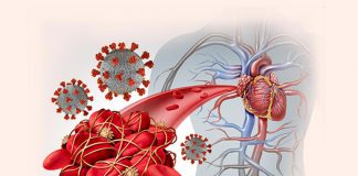 Đặc điểm huyết học, cơ chế hình thành huyết khối và điều trị kháng đông ở bệnh nhân COVID-19