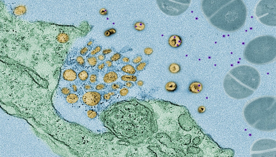 Hình ảnh kính hiển vi điện tử cho thấy 'exosome' (màu vàng)