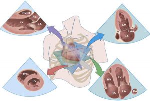 Hình 2-1 Mặt cắt cơ bản trong siêu âm tim qua thành ngực.