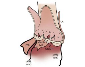 Hình 2-5 Giải phẫu van động mạch chủ.