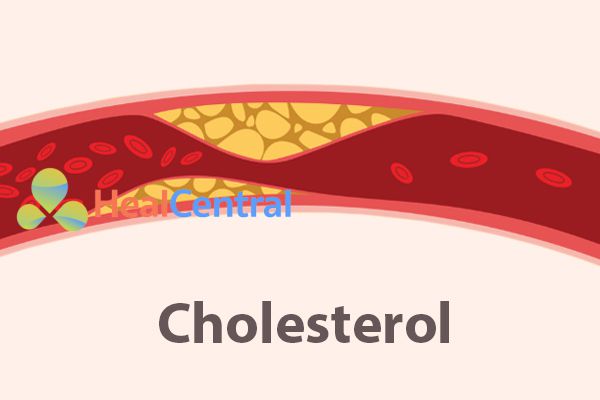 Thuốc Lipitor được chỉ định sử dụng cho những bệnh nhân tăng cholesterol máu