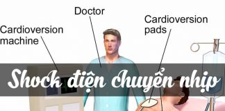 Shock điện chuyển nhịp