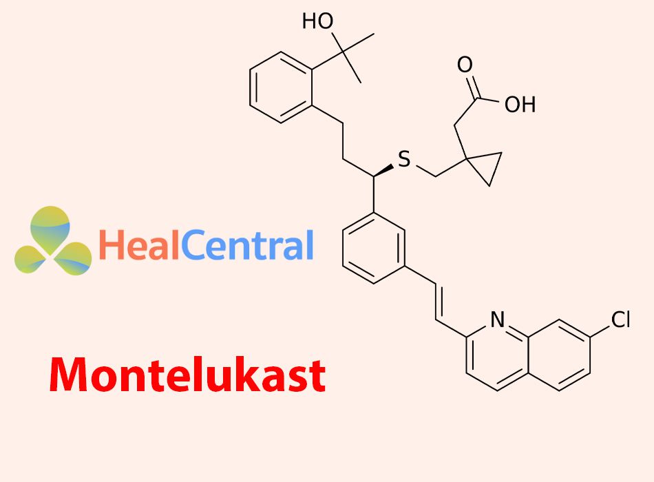 Công thức hóa học của Montelukast