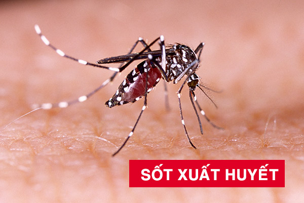 Sốt xuất huyết: Nguyên nhân, chẩn đoán & phương pháp điều trị