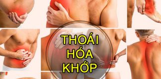 Thoái hóa khớp