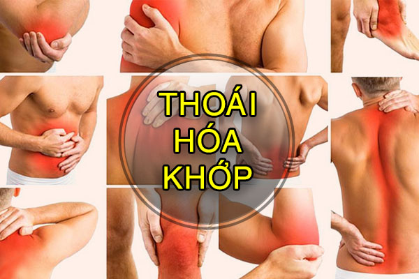 Thoái hóa khớp: Nguyên nhân, triệu chứng & các phương pháp điều trị