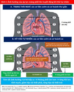 Hình 1 Ảnh hưởng của áp lực màng phổi lên huyết động khi thở tự nhiên