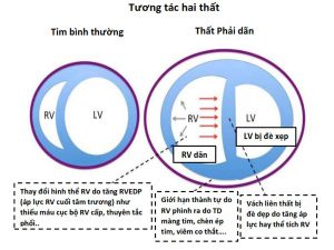 Tương tác hai thất