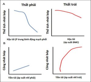 PPV và ảnh hưởng sinh lý lên thất phải