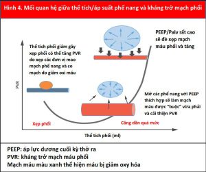 Hình 4. Mối quan hệ giữa thể tích/áp suất phế nang và kháng trở mạch phổi